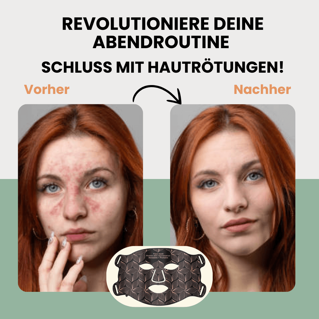 SkinLUX LED-Gesichtsmaske - Für strahlend glatte Haut